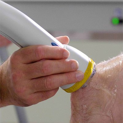 Chiropractic Anchorage AK SoftWave Therapy Gel Knee Chiropractic Anchorage AK SoftWave Therapy Gel Knee